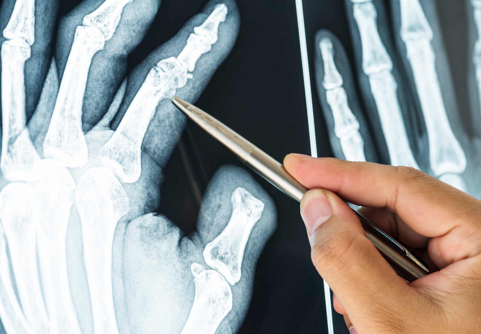 Top Orthopedic Doctor in Rahatani