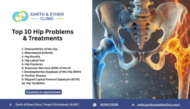 Top 10 Common Hip Problems and Their Treatments Explained