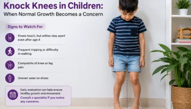 Doctor examining a child's knock knees during a pediatric orthopedic checkup
